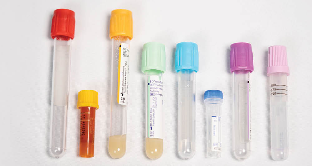 image of baby test tubes used pediactric testing